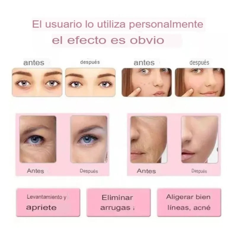 Masajeador Limpieza Facial - Ultrasonico